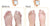 K Kudos Soft Silicon Gel Half Toe Sleeve Forefoot Pads For Pain Relief